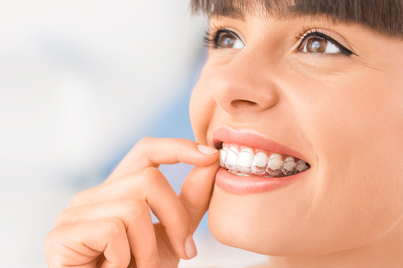 Special Dental Offer Milpitas